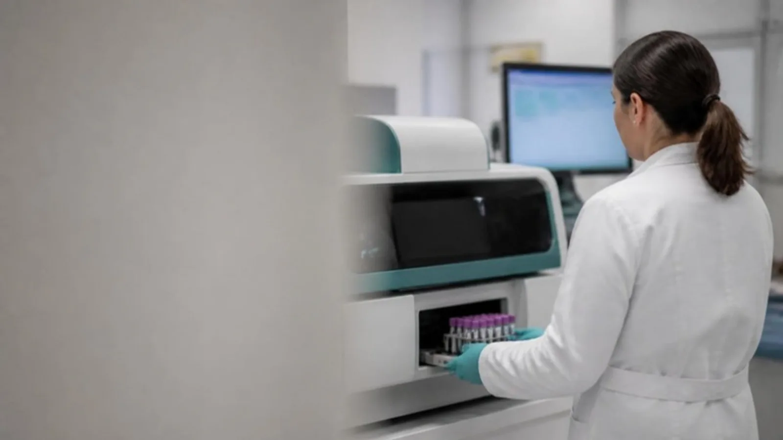 Clinical laboratory analyst at a hospital lab workstation loading a tray of sample tubes into an automated analyser, with the results screen blurred behind